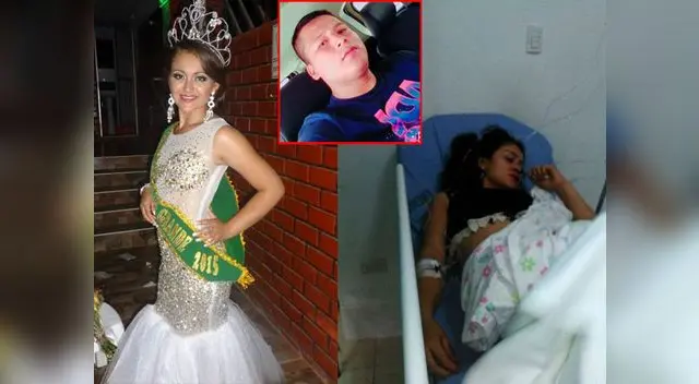 Denuncia de presunta agresión física y abuso sexual ocurrió en Huánuco