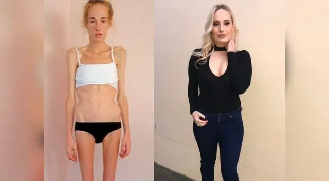 Padre se quedaba despierto toda la noche para ver si su hija seguía respirando Padre se quedaba despierto toda la noche para ver si su hija seguía respirando