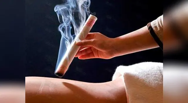 Las bondades de la moxibustión Las bondades de la moxibustión