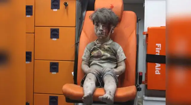 Pequeño Omran lleno de heridas