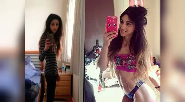 Joven de 25 años superó la anorexia y ahora es instructora fitness Joven de 25 años superó la anorexia y ahora es instructora fitness