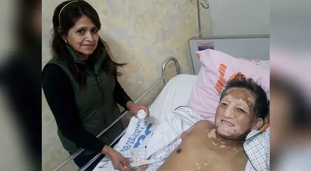 EL chato sonrie pese a que su estado es demasiado delicado