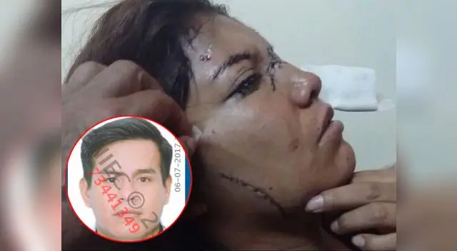 Poder Judicial ordenó la captura contra Anthony Oré Reyes por agredir a Luz Giannina Vásquez Ambicho