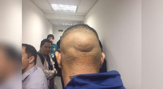 Así luce la cabeza Guerrero tras sufrir el cabezazo que lo sacó del partido Así luce la cabeza Guerrero tras sufrir el cabezazo que lo sacó del partido