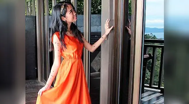 Joven espera inspirar a las demás personas a aceptarse como son Joven espera inspirar a las demás personas a aceptarse como son