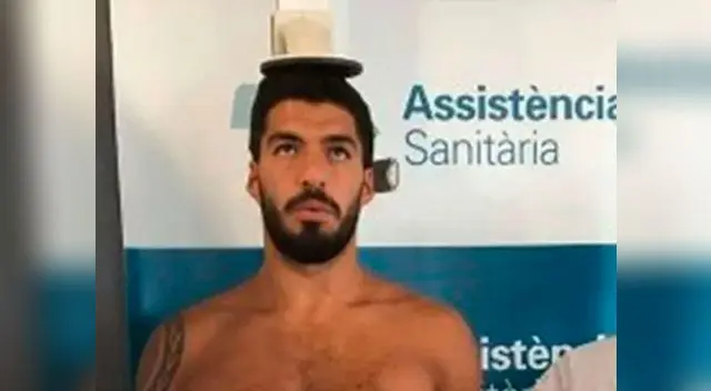 ¿Marcas de nacimiento?