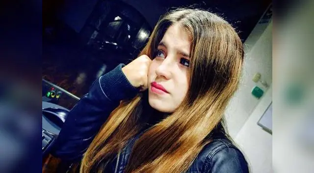 ¿Qué le pasó en el rostro a Flavia Laos? ¿Qué le pasó en el rostro a Flavia Laos?