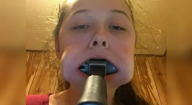 Meterse un martillo a la boca le costó caro Meterse un martillo a la boca le costó caro