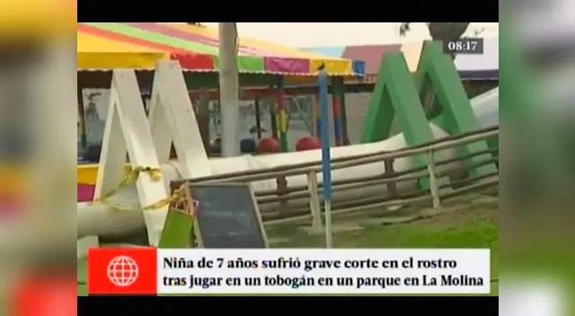 Niña sufre corte por tobogán en mal estado en parque de la Molina