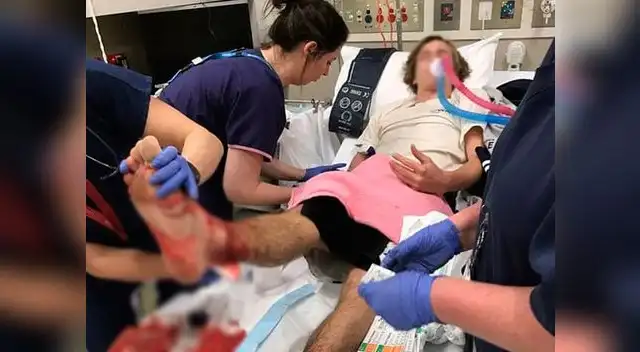 Joven casi fue comido vivo por extrañas criaturas