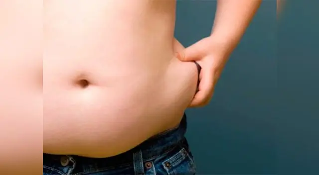 Mal nutrición y la genética son las causas de la obesidad