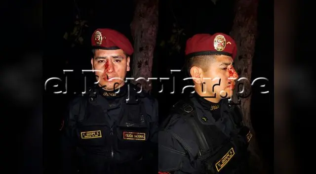 Suboficial de la PNP fue agredido brutalmente por luchadores de artes marciales Suboficial de la PNP fue agredido brutalmente por luchadores de artes marciales