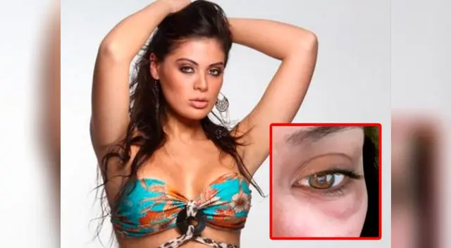 ¿Qué le pasó a Georgette Cárdenas?