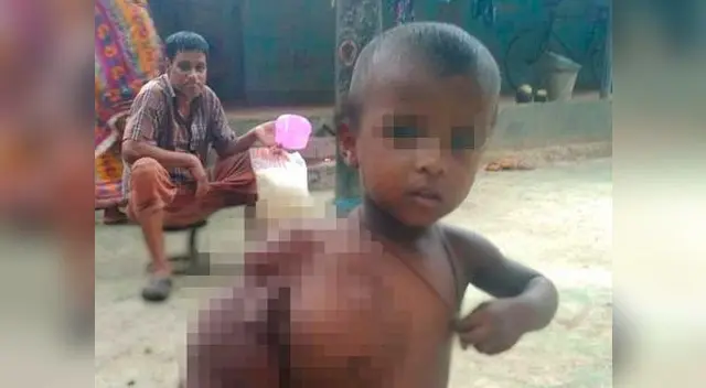 Niña con malformación en brazo enternece en Facebook Niña con malformación en brazo enternece en Facebook