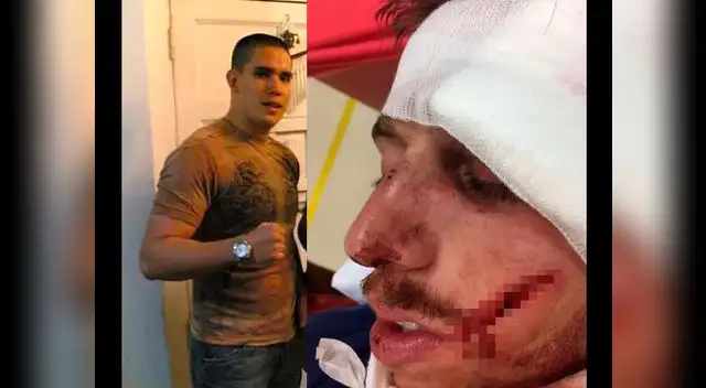 Poder Judicial confirmó los cuatro años de prisión que se le impuso al peleador de muay thai Fredy Lescano Aleman