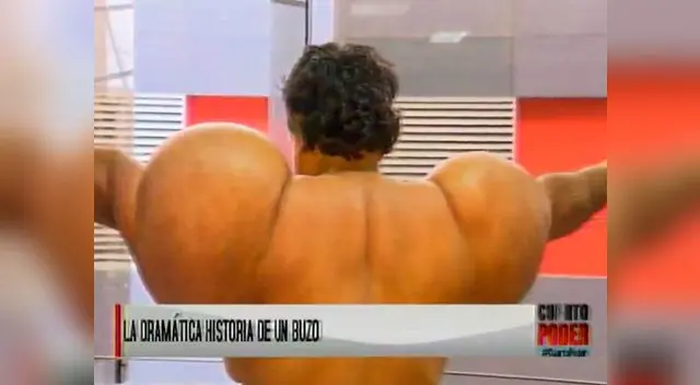 Extraña enfermedad aqueja a buzo debido al nitrógeno en su cuerpo