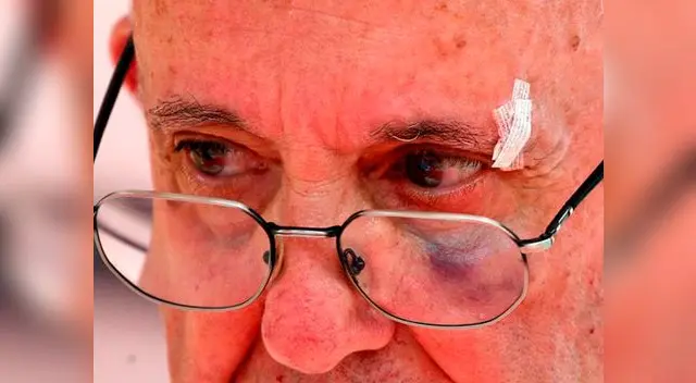 El Papa había sufrido un golpe dentro de su papamóvil