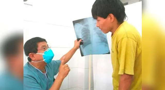 Personas con tuberculosis podrían terminar seriamente afectados sino tratan a tiempo sus males