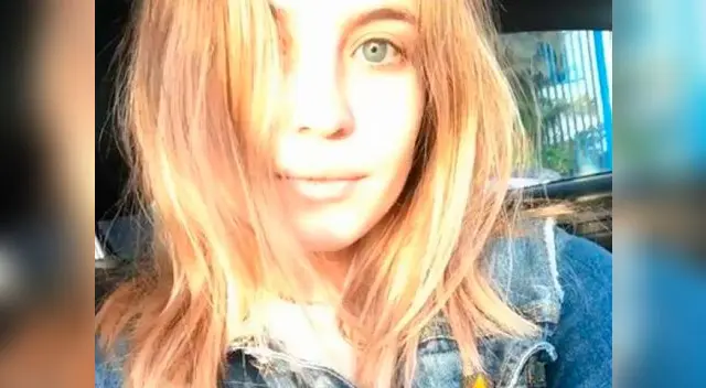 Flavia Laos evita mostrar su ojo derecho