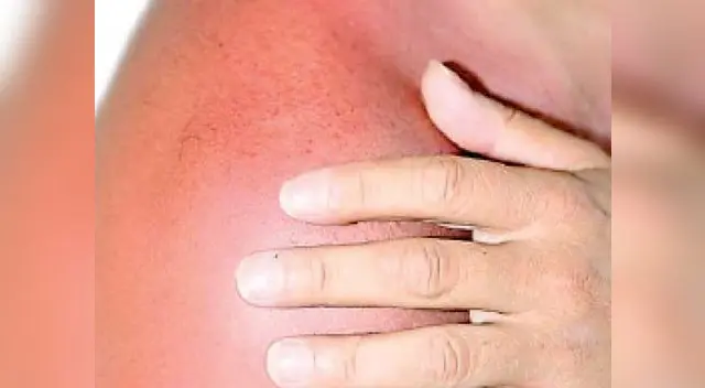 Aplicar vitamina e directo al rostro favorece la producción de colágeno Aplicar vitamina e directo al rostro favorece la producción de colágeno