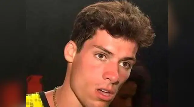 Patricio Parodi muestra el daño que se hizo en el rostro durante su viaje a Panamá Patricio Parodi muestra el daño que se hizo en el rostro durante su viaje a Panamá