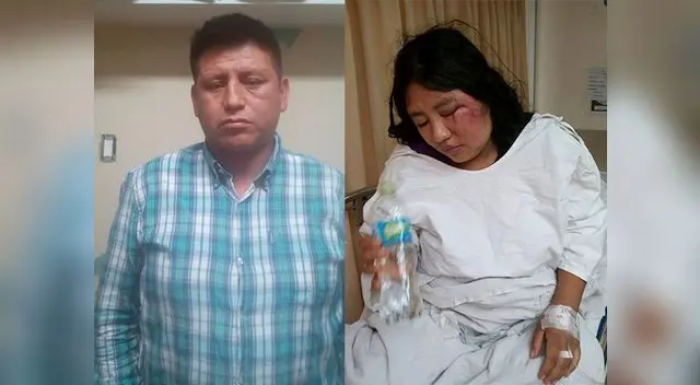 La mujer puede perder el ojo izquierdo por la gravedad de los golpes