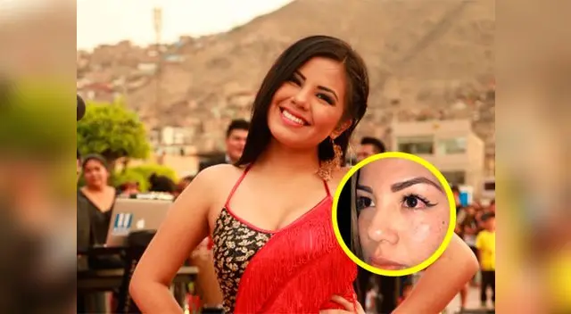 Estrella Torres recibió un terrible cachetadón Estrella Torres recibió un terrible cachetadón