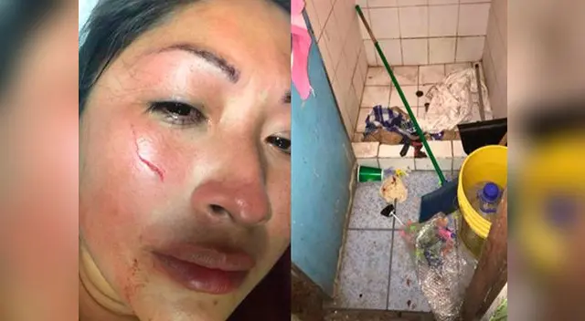 Mujer es agredida por su pareja y lo dejan libre 