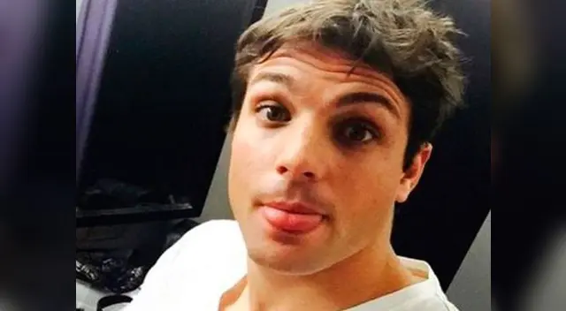 Nicola Porcella muestra como le quedó el rostro luego de recibir una golpiza