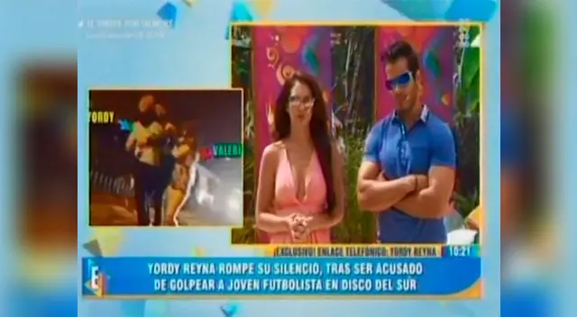 Yordy Reyna rompió su silencio tras haber sido acusado de agresión física Yordy Reyna rompió su silencio tras haber sido acusado de agresión física