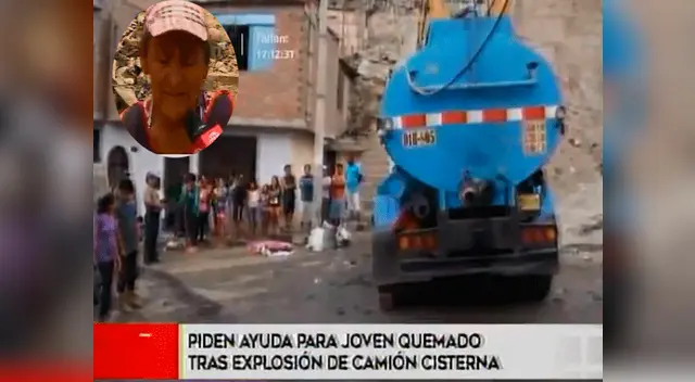 Madre pide ayuda para joven quemado tras explosión de camión cisterna en Huaycán