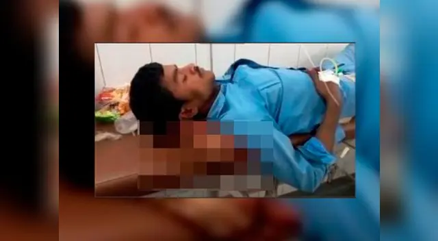 Paciente utiliza una pierna amputada como almohada 