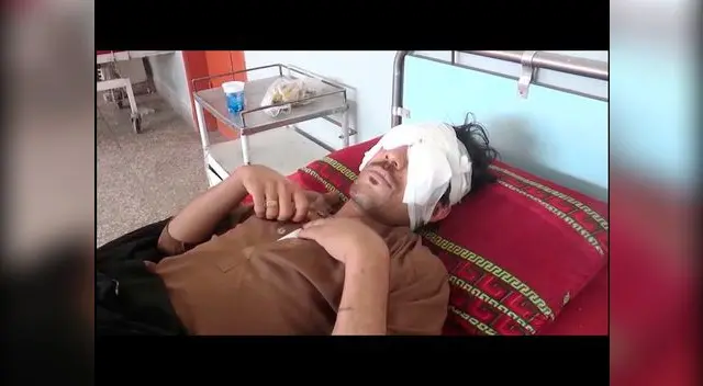 Padre y hermanos dejaron ciego a novio que intentaba casarse en Pakistán