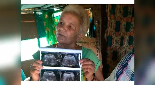 Mexicana de 70 años podría ser la mujer más longeva en dar a luz