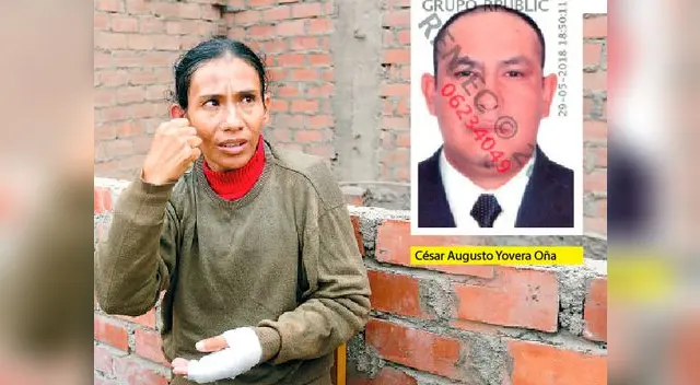 Mujer fue brutalmente golpeada por su expareja para no darle pensión a sus hijos | Foto: Flavio Matos Mujer fue brutalmente golpeada por su expareja para no darle pensión a sus hijos | Foto: Flavio Matos