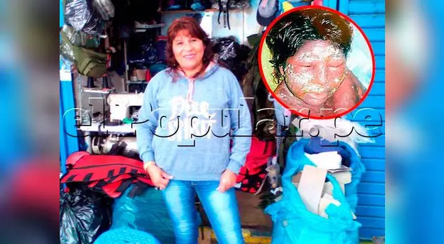 Eizabeth Alanya fue quemada como Eivy Ágreda y su agresor saldrá en un mes de prisión