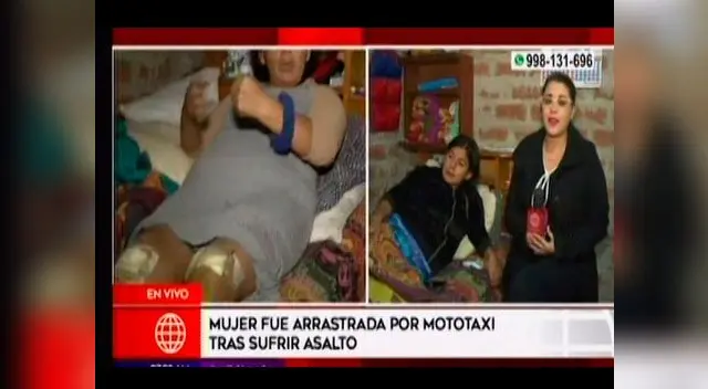 A enfermera le pasaron mototaxi por el cuerpo para robarle en SJM 