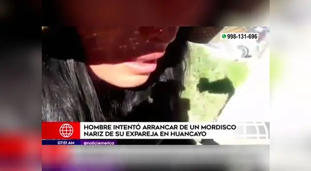 A joven profesora casi le arrancan la nariz A joven profesora casi le arrancan la nariz