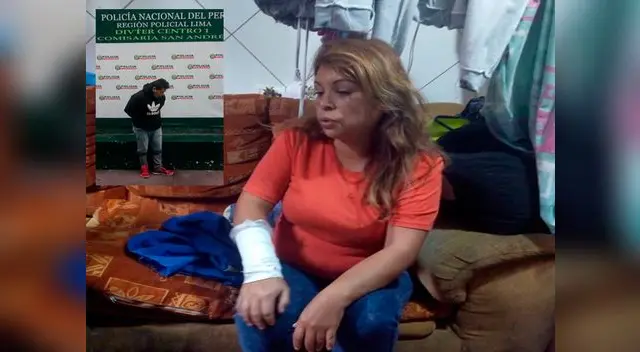 Una mujer fue atacada en el Cercado de Lima por su ex pareja Una mujer fue atacada en el Cercado de Lima por su ex pareja