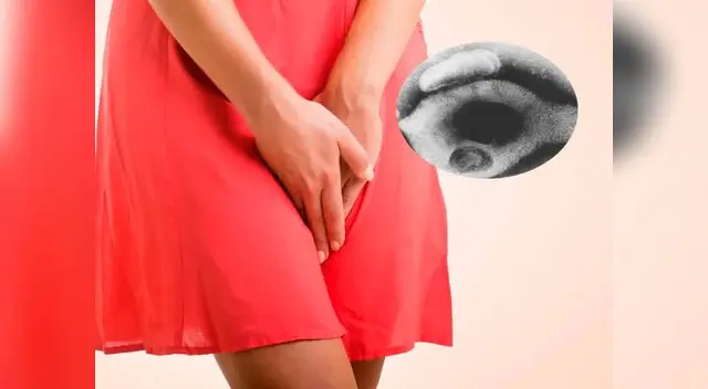 ETS que podría convertirse en la nueva superbacteria