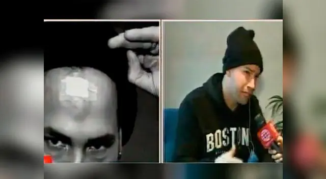  Kevin Blow denuncia extorsión después de violento robo