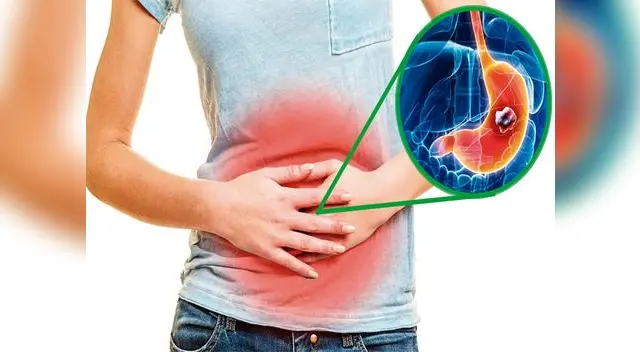 Se debe realizarse un chequeo preventivo mínimo una vez al año Se debe realizarse un chequeo preventivo mínimo una vez al año