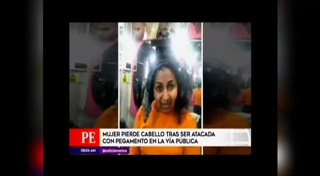 Comerciante atacada con pegamento en la cabeza Comerciante atacada con pegamento en la cabeza