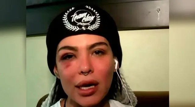 Angie Jibaja le hace importante pedido a la ministra de la Mujer