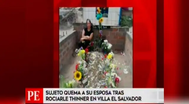 Mujer fue quemada en el rostro y otras partes del cuerpo