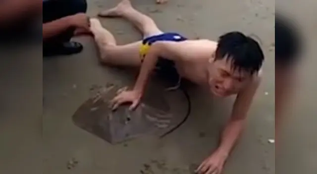 Al lugar llegaron personal de bomberos para auxiliar al hombre que quedó muy adolorido.