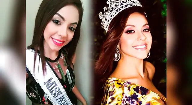 Miss Cajamarca se recupera de fractura de cráneo