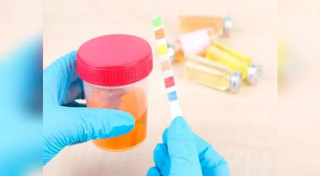 Cuando es amarillo pálido o transparente, es señal de que gozas de muy buena salud Cuando es amarillo pálido o transparente, es señal de que gozas de muy buena salud