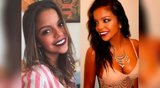 Johana Cubillas revela que padece enfermedad a la piel con peculiar tatuaje