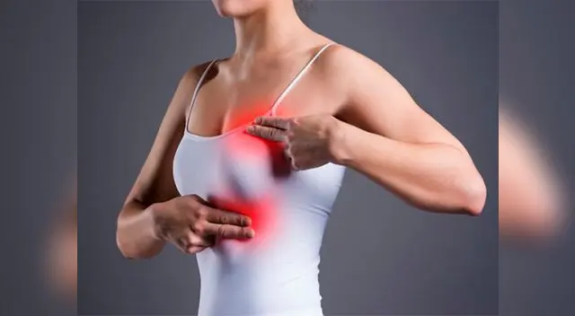  El cáncer de mama no presenta síntomas en su etapa inicial y en la mayoría de casos se detecta en estado avanzado